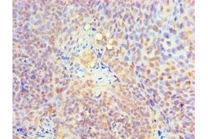 Immunohistochemistry of paraffin-embedded human tonsil tissue using ABIN7157727 at dilution of 1:100 (KLF4 Antikörper  (AA 30-230))
