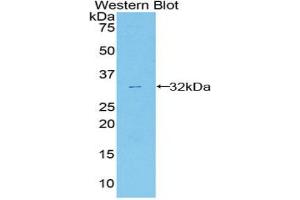 Western blot analysis of the recombinant protein. (ANXA6 Antikörper  (AA 251-504))