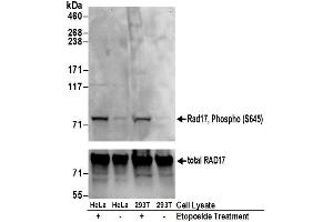 Western Blotting (WB) image for anti-RAD17 (RAD17) (pSer645) antibody (ABIN7449387)