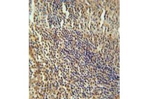 Immunohistochemistry analysis in formalin fixed and paraffin embedded human tonsil tissue reacted with MEF2A Antibody (Center) followed which was peroxidase conjugated to the secondary antibody and followed by DAB staining. (MEF2A Antikörper  (Middle Region))