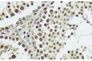 Immunohistochemistry of paraffin-embedded Rat testis using Phospho-Histone H3(T11) Polyclonal Antibody at dilution of 1:100 (40x lens). (Histone 3 Antikörper  (pThr11))