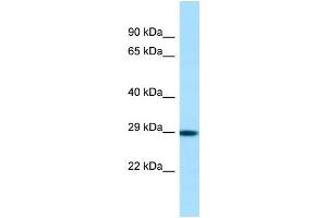 Host: Rabbit Target Name: Phox2b Sample Type: Rat Stomach lysates Antibody Dilution: 1. (PHOX2B Antikörper  (N-Term))
