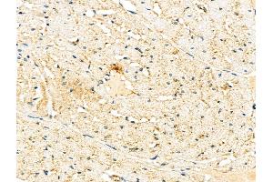 ABIN6261435 and ABIN6276463 at 1/100 staining Rat heart tissue by IHC-P. (Endothelin 3 Antikörper  (C-Term))