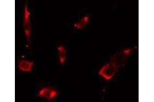 ABIN6275670 staining LOVO cells by IF/ICC. (VPS26B Antikörper  (Internal Region))