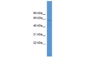 WB Suggested Anti-TMEM180 Antibody Titration:  0. (TMEM180 Antikörper  (Middle Region))
