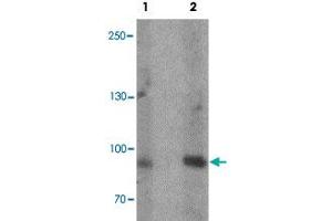 Western blot analysis of rat heart tissue lysate with FCHO2 polyclonal antibody  at (1) 1 and (2) 2 ug/mL. (FCHO2 Antikörper  (Internal Region))