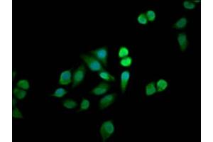 Immunofluorescence staining of Hela cells with ABIN7160633 at 1:33, counter-stained with DAPI. (MTMR12 Antikörper  (AA 188-318))