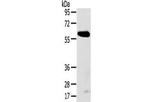 Gel: 8 % SDS-PAGE,Lysate: 40 μg,Primary antibody: ABIN7192624(SPATA18 Antibody) at dilution 1/250 dilution,Secondary antibody: Goat anti rabbit IgG at 1/8000 dilution,Exposure time: 5 minutes (SPATA18 Antikörper)
