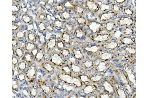 IHC analysis of ASAH1 using anti-ASAH1 antibody (ABIN7602206).