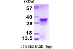 SDS-PAGE (SDS) image for MRG-Binding Protein (MRGBP) (AA 1-204) protein (His tag) (ABIN7279641)