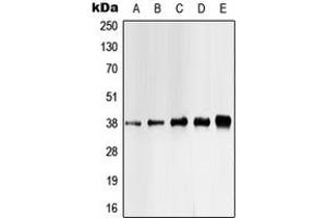 Western blot analysis of CK1 alpha (pY321) expression in HEK293T UV-treated (A), Jurkat (B), K562 (C), mouse liver (D), H9C2 UV-treated (E) whole cell lysates. (CSNK1A1 Antikörper  (C-Term, pTyr321))