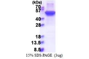 SDS-PAGE (SDS) image for Keratin 17 (KRT17) (AA 1-432) protein (His tag) (ABIN5853572)