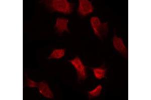 ABIN6267632 staining 293 by IF/ICC. (AMPK alpha Antikörper  (pThr172))