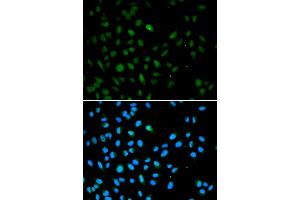 Immunofluorescence analysis of A549 cells using EZH1 antibody (ABIN5973432). (EZH1 Antikörper)