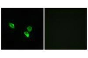 Immunofluorescence analysis of MCF-7 cells, using MRPS18C antibody. (MRPS18C Antikörper)