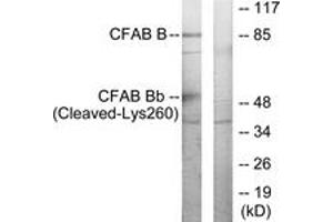 Western Blotting (WB) image for anti-Complement Factor B (CFB) (AA 241-290), (Cleaved-Lys260) antibody (ABIN2891191) (Complement Factor B Antikörper  (Cleaved-Lys260))