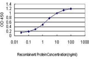 Detection limit for recombinant GST tagged CRYM is approximately 0.