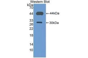 Detection of Recombinant CD4, Mouse using Polyclonal Antibody to Cluster Of Differentiation 4 (CD4) (CD4 Antikörper  (AA 27-394))