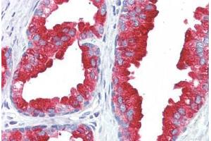 Human Prostate (formalin-fixed, paraffin-embedded) stained with ACPP antibody ABIN364499 at 5 ug/ml followed by biotinylated anti-mouse IgG secondary antibody ABIN481714, alkaline phosphatase-streptavidin and chromogen. (ACPP Antikörper)