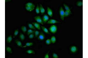 Immunofluorescence staining of A549 cells with ABIN7154498 at 1:100, counter-stained with DAPI. (GRB14 Antikörper  (AA 294-397))