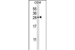 Western blot analysis in CEM cell line lysates (35ug/lane). (PLGF Antikörper  (AA 120-148))