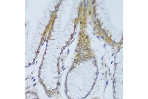 Immunohistochemistry (IHC) image for anti-EF-Hand Calcium Binding Domain 4B (EFCAB4B) (AA 1-200) antibody (ABIN6138999)