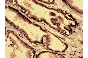 Immunohistochemistry analysis of human prostate tissue using ABIN7148523 at dilution of 1:100 (Copine IV Antikörper  (AA 1-280))