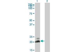 Western Blot analysis of HAND2 expression in transfected 293T cell line by HAND2 monoclonal antibody (M10), clone 3F10. (HAND2 Antikörper  (AA 135-216))