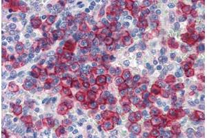 Human Spleen (formalin-fixed, paraffin-embedded) stained with NCOA3 antibody ABIN462179 followed by biotinylated goat anti-rabbit IgG secondary antibody ABIN481713, alkaline phosphatase-streptavidin and chromogen. (NCOA3 Antikörper  (AA 576-625))