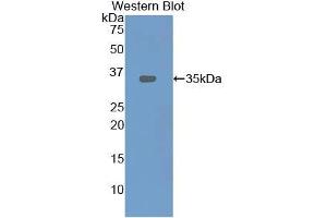 Western blot analysis of recombinant Rat LOX1. (OLR1 Antikörper  (AA 51-314))