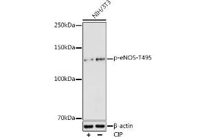 Western blot analysis of extracts of NIH/3T3 cells, using Phospho-eNOS-T495 antibody (ABIN6135215, ABIN6136066, ABIN6136067 and ABIN6225549) at 1:1000 dilution. (ENOS Antikörper  (pThr495))