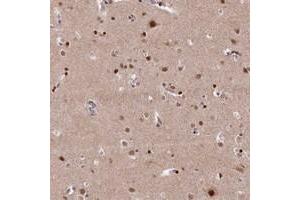 Immunohistochemical staining of human cerebral cortex with MCF2L2 polyclonal antibody  shows strong nuclear positivity in neuronal cells at 1:20-1:50 dilution. (MCF2L2 Antikörper)
