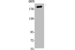 Western Blot analysis of K562, cells using Phospho-Tensin-1 (Y1326) Polyclonal Antibody (Tensin 1 Antikörper  (pTyr1326))