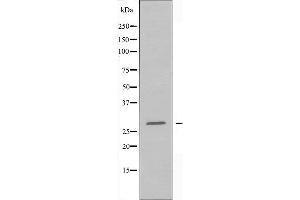 Western blot analysis of extracts from 293 cells, using BRMS1 antibody. (BRMS1 Antikörper  (N-Term))