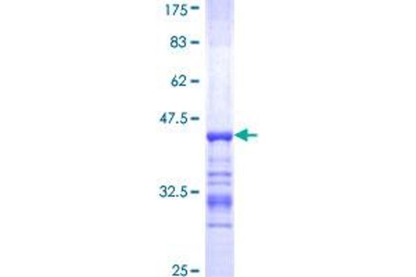 alpha Actinin 4 Protein (AA 592-701) (GST tag)