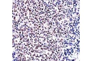 Immunohistochemistry (IHC) image for anti-Nuclear Factor of Activated T-Cells, Cytoplasmic, Calcineurin-Dependent 1 (NFATC1) (AA 898-927) antibody (ABIN3032038)