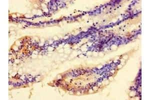 Immunohistochemistry of paraffin-embedded human small intestine tissue using ABIN7174920 at dilution of 1:100