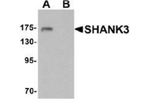 Western blot analysis of SHANK3 in 3T3 cell lysate with SHANK3 antibody at 1 ug/ml in (A) the absence and (B) the presence of blocking peptide. (SHANK3 Antikörper  (Middle Region))