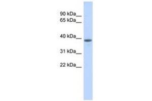Image no. 1 for anti-DDB1 and CUL4 Associated Factor 4-Like 1 (DCAF4L1) (AA 323-372) antibody (ABIN6741260)