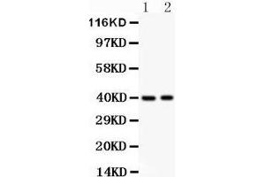 Anti- MUM1 antibody, Western blotting All lanes: Anti MUM1  at 0. (IRF4 Antikörper  (AA 272-451))