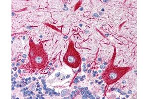 Anti-SLC15A1 antibody IHC of human brain, cerebellum. (SLC15A1 Antikörper  (C-Term))