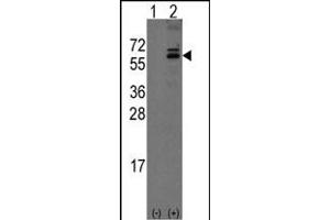 Western blot analysis of Noelin-1(Olfm1) (arrow) using rabbit polyclonal Noelin-1(Olfm1) Antibody (C-term) (ABIN389178 and ABIN2839341).