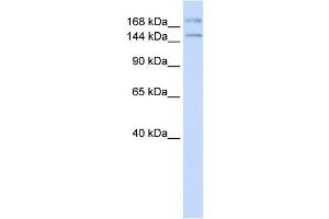 WB Suggested Anti-IFT140 Antibody Titration:  0. (IFT140 Antikörper  (N-Term))