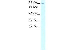 WB Suggested Anti-ZNF341 Antibody Titration: 2. (ZNF341 Antikörper  (N-Term))
