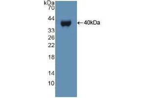 Detection of Recombinant UBE3A, Human using Polyclonal Antibody to Ubiquitin Protein Ligase E3A (UBE3A) (ube3a Antikörper  (AA 158-407))
