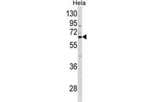 Western blot analysis of CTPS2 Antibody (N-term) in Hela cell line lysates (35ug/lane).