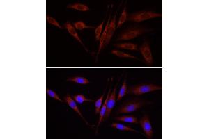 Immunofluorescence (IF) image for anti-Wingless-Type MMTV Integration Site Family, Member 1 (WNT1) (AA 231-370) antibody (ABIN1683291)