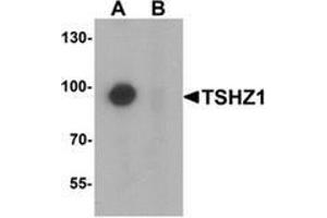 Western blot analysis of TSHZ1 in A-20 cell lysate with TSHZ1 Antibody  at 1 µg/ml in (A) the absence and (B) the presence of blocking peptide. (TSHZ1 Antikörper  (N-Term))