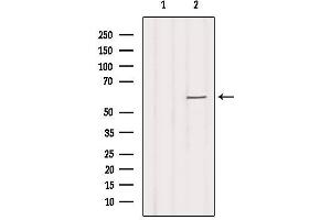 Western blot analysis of extracts from Hela, using SLC16A2 Antibody. (SLC16A2/MCT8 Antikörper  (Internal Region))