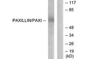 Western blot analysis of extracts from HeLa cells, using Paxillin (Ab-118) Antibody. (Paxillin Antikörper  (AA 85-134))